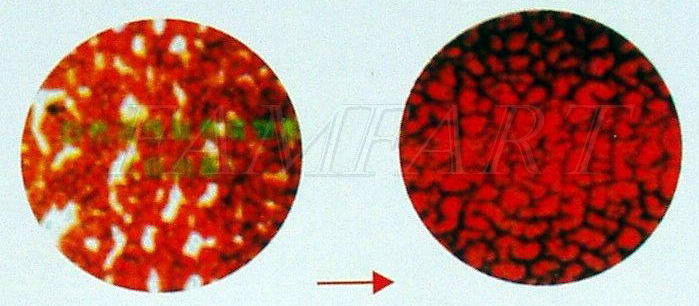 Krwinki przed i po oczyszczaniu